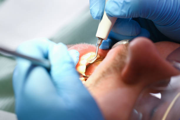 Best Urgent Care for Lost Fillings or Crowns in Miramar Beach, FL