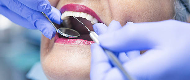 Best Emergency Dental Care for Broken or Chipped Teeth in Miramar Beach, FL